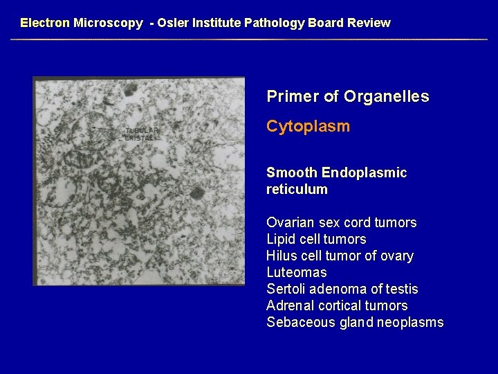 Electron Microscopy - Osler Institute Pathology Board Review Primer of Organelles Cytoplasm Smooth Endoplasmic