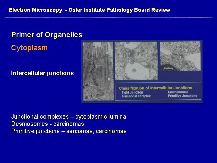 Electron Microscopy - Osler Institute Pathology Board Review Primer of Organelles Cytoplasm Intercellular junctions