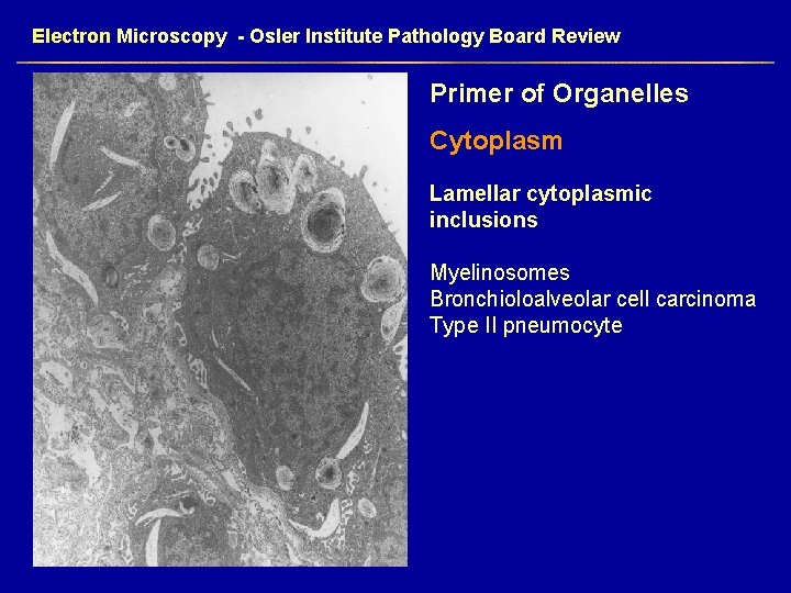 Electron Microscopy - Osler Institute Pathology Board Review Primer of Organelles Cytoplasm Lamellar cytoplasmic