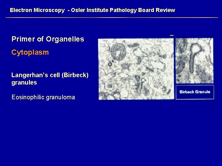 Electron Microscopy - Osler Institute Pathology Board Review Primer of Organelles Cytoplasm Langerhan’s cell