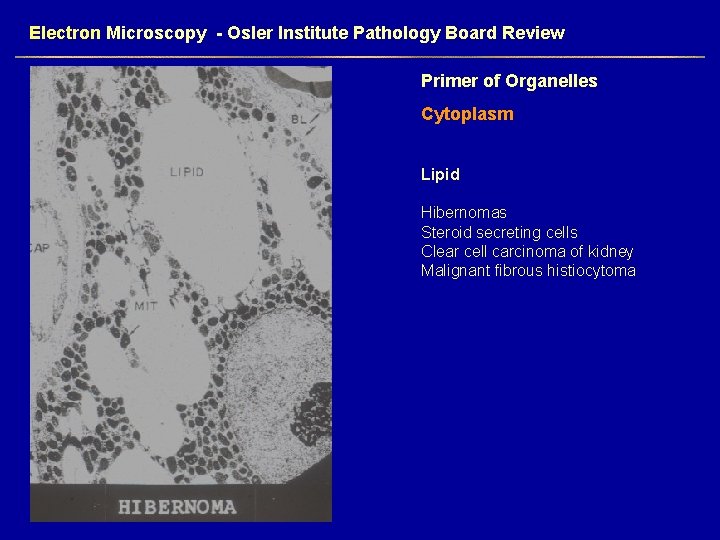 Electron Microscopy - Osler Institute Pathology Board Review Primer of Organelles Cytoplasm Lipid Hibernomas