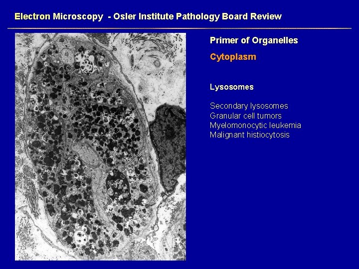 Electron Microscopy - Osler Institute Pathology Board Review Primer of Organelles Cytoplasm Lysosomes Secondary