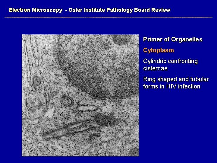 Electron Microscopy - Osler Institute Pathology Board Review Primer of Organelles Cytoplasm Cylindric confronting