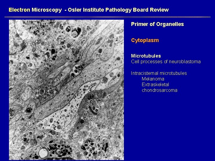 Electron Microscopy - Osler Institute Pathology Board Review Primer of Organelles Cytoplasm Microtubules Cell
