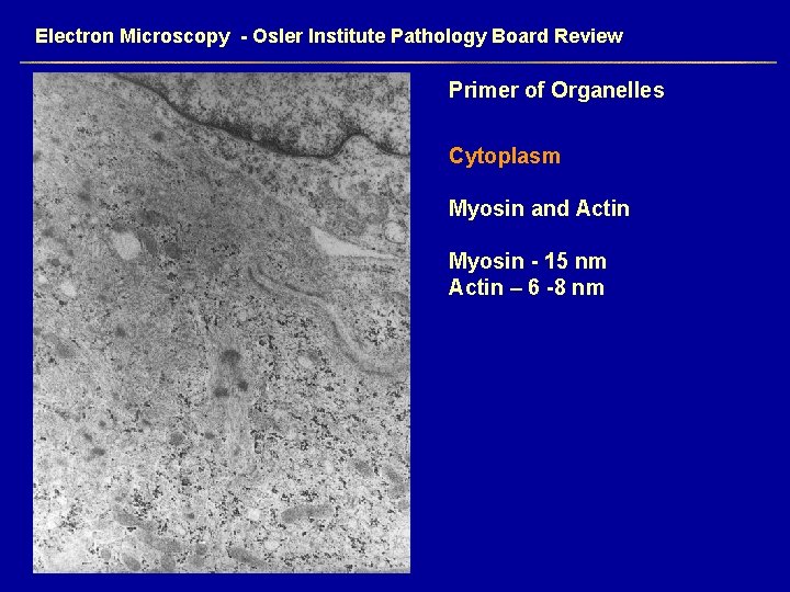 Electron Microscopy - Osler Institute Pathology Board Review Primer of Organelles Cytoplasm Myosin and