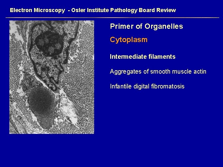 Electron Microscopy - Osler Institute Pathology Board Review Primer of Organelles Cytoplasm Intermediate filaments