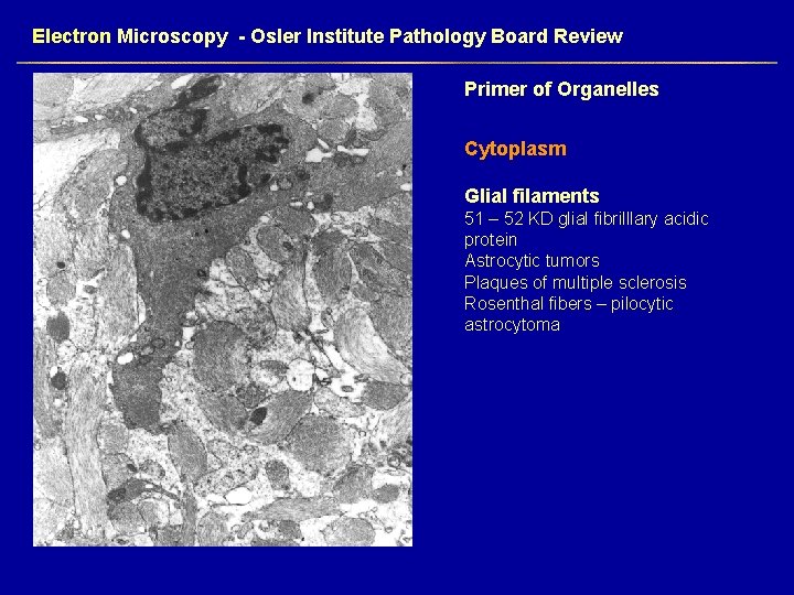 Electron Microscopy - Osler Institute Pathology Board Review Primer of Organelles Cytoplasm Glial filaments