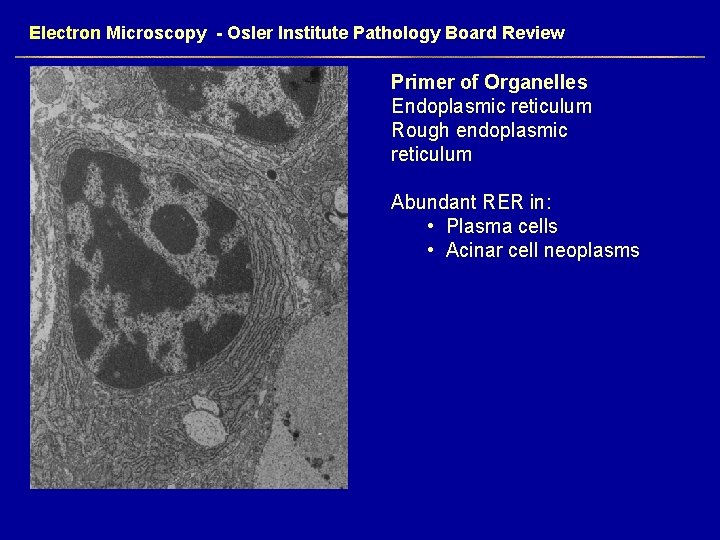 Electron Microscopy - Osler Institute Pathology Board Review Primer of Organelles Endoplasmic reticulum Rough