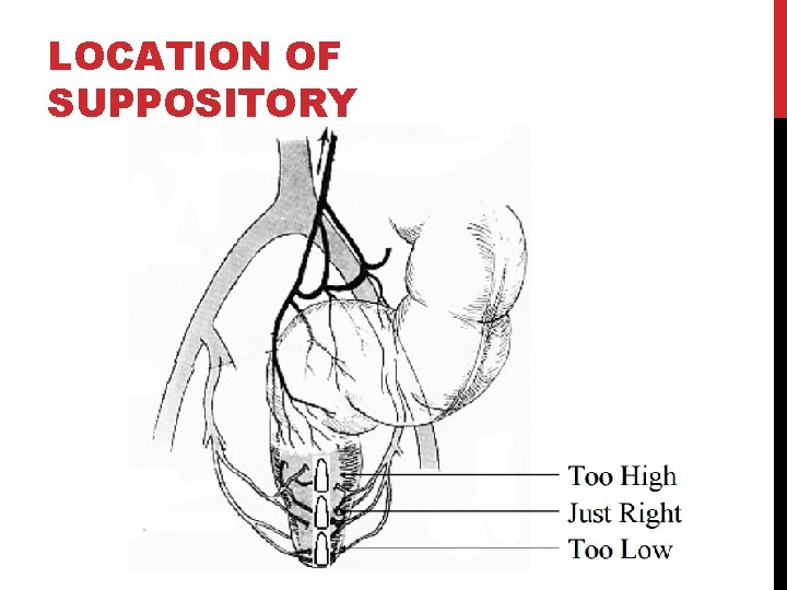 LOCATION OF SUPPOSITORY 