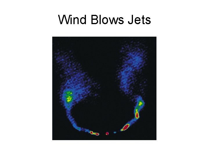 Wind Blows Jets 