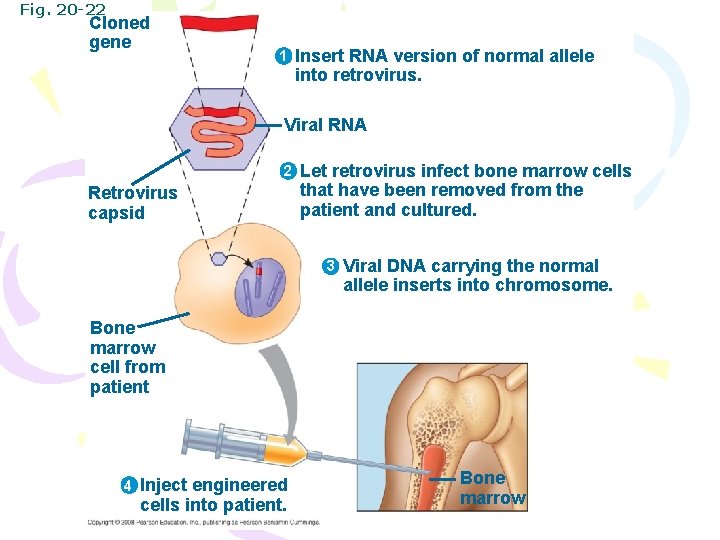Fig. 20 -22 Cloned gene 1 Insert RNA version of normal allele into retrovirus.