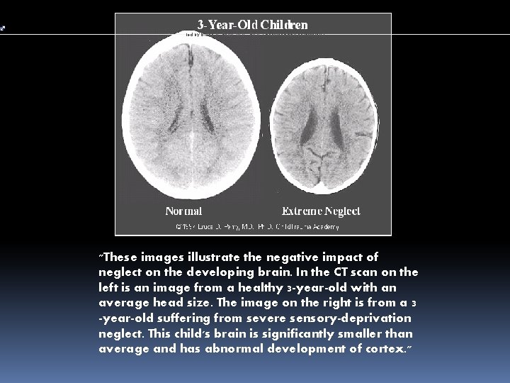 led by Bruce D. Perry, M. D. , Ph. D. (Reprinted with permission. )