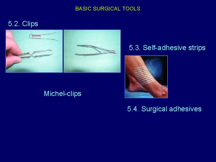 BASIC SURGICAL TOOLS 5. 2. Clips 5. 3. Self-adhesive strips Michel-clips 5. 4. Surgical