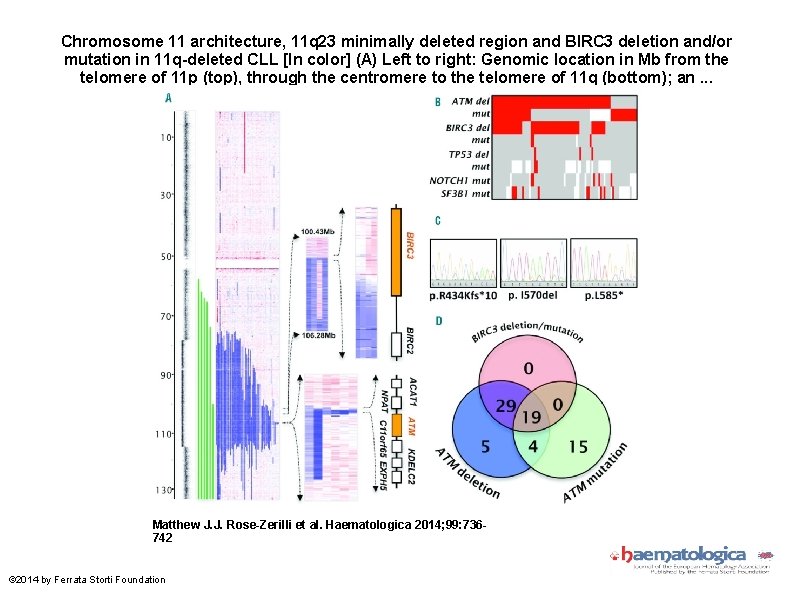 Chromosome 11 architecture, 11 q 23 minimally deleted region and BIRC 3 deletion and/or Chromosome 11 architecture, 11 q 23 minimally deleted region and BIRC 3 deletion and/or