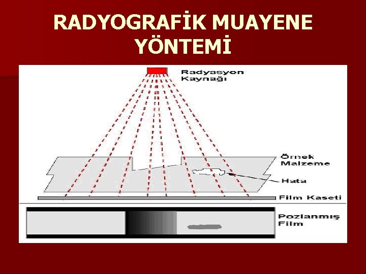 RADYOGRAFİK MUAYENE YÖNTEMİ 