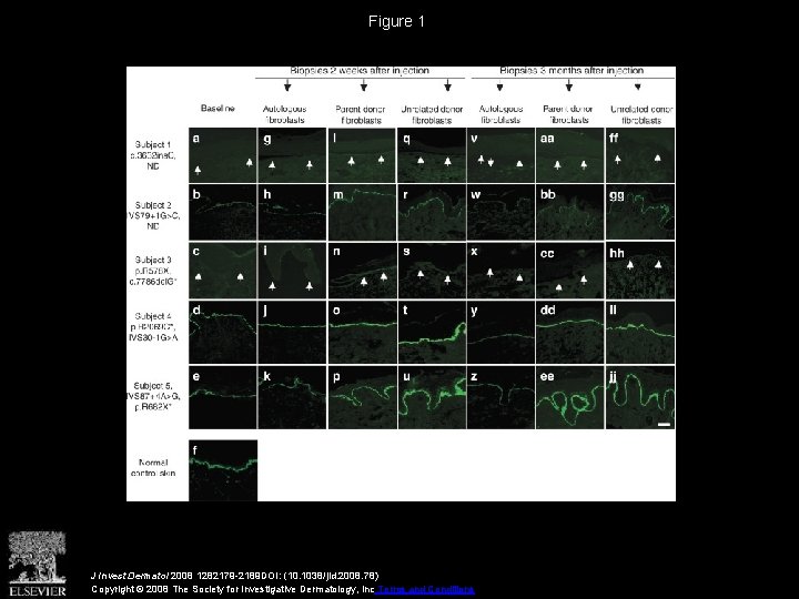Figure 1 J Invest Dermatol 2008 1282179 -2189 DOI: (10. 1038/jid. 2008. 78) Copyright