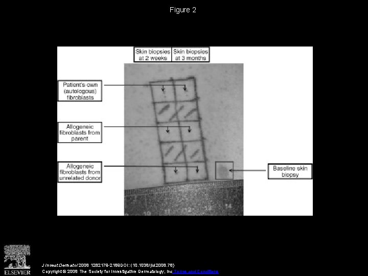 Figure 2 J Invest Dermatol 2008 1282179 -2189 DOI: (10. 1038/jid. 2008. 78) Copyright