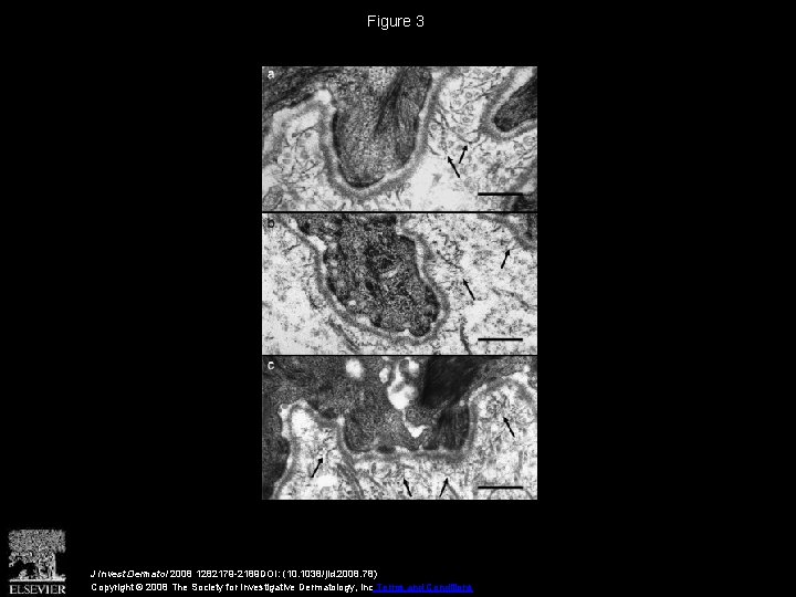 Figure 3 J Invest Dermatol 2008 1282179 -2189 DOI: (10. 1038/jid. 2008. 78) Copyright