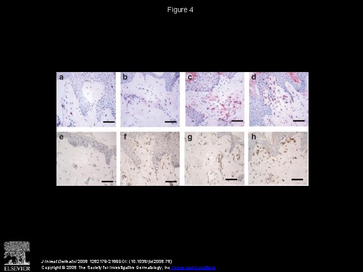Figure 4 J Invest Dermatol 2008 1282179 -2189 DOI: (10. 1038/jid. 2008. 78) Copyright