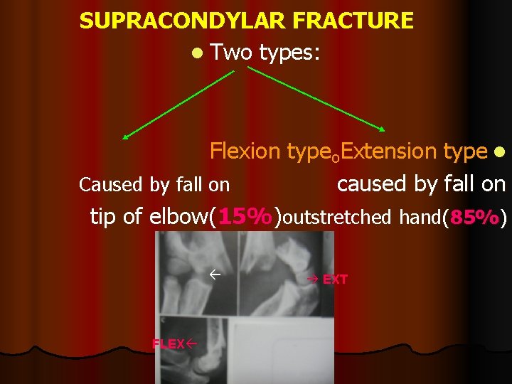 SUPRACONDYLAR FRACTURE l Two types: Flexion typeₒExtension type l Caused by fall on caused