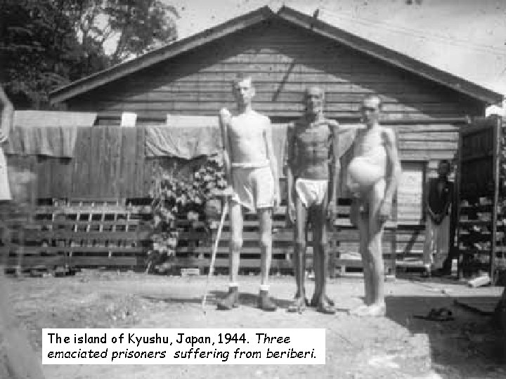 The island of Kyushu, Japan, 1944. Three emaciated prisoners suffering from beri. 