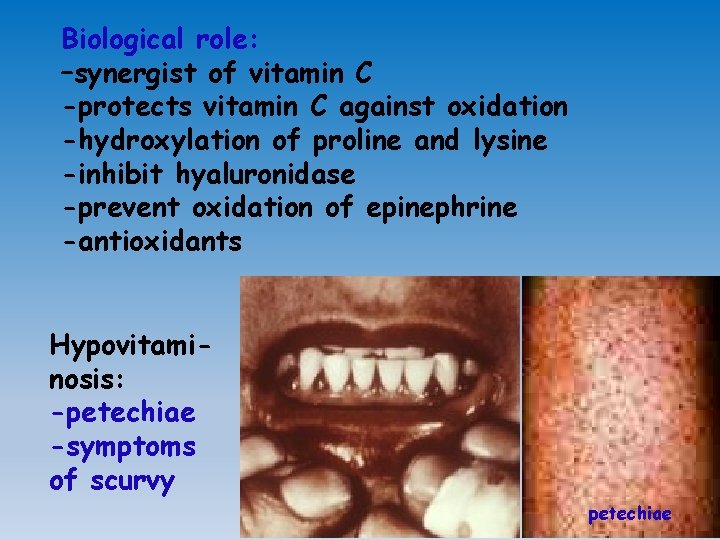 Biological role: –synergist of vitamin C -protects vitamin C against oxidation -hydroxylation of proline