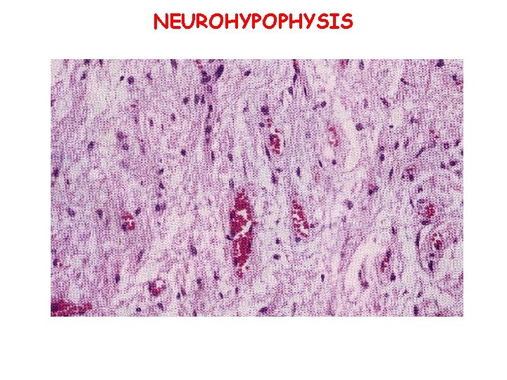NEUROHYPOPHYSIS 
