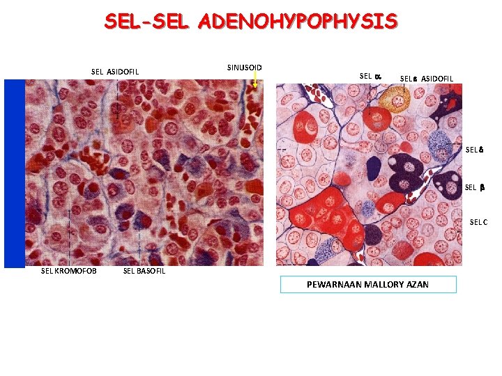 SEL-SEL ADENOHYPOPHYSIS SEL ASIDOFIL SINUSOID SEL ASIDOFIL SEL C SEL KROMOFOB SEL BASOFIL PEWARNAAN