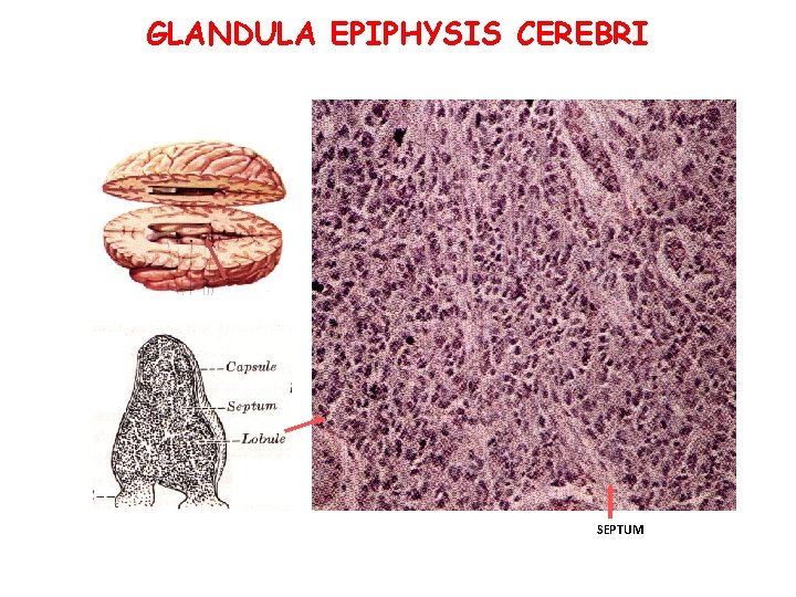 GLANDULA EPIPHYSIS CEREBRI SEPTUM 