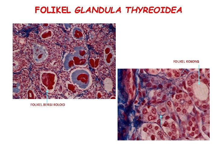 FOLIKEL GLANDULA THYREOIDEA FOLIKEL KOSONG FOLIKEL BERISI KOLOID SEL PARAFOLIKULER 