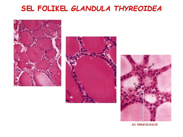 SEL FOLIKEL GLANDULA THYREOIDEA SEL PARAFOLIKULER 