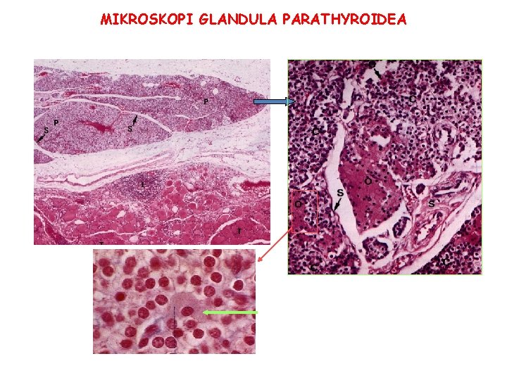 MIKROSKOPI GLANDULA PARATHYROIDEA SEL OXYPHIL 