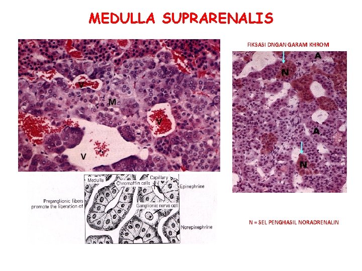 MEDULLA SUPRARENALIS FIKSASI DNGAN GARAM KHROM A = SEL PENGHASIL ADRENALIN N = SEL