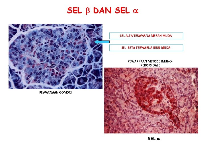 SEL DAN SEL ALFA TERWARNA MERAH MUDA SEL BETA TERWARNA BIRU MUDA PEWARNAAN METODE