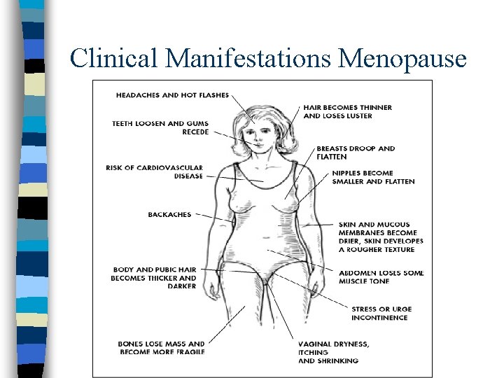 Clinical Manifestations Menopause 