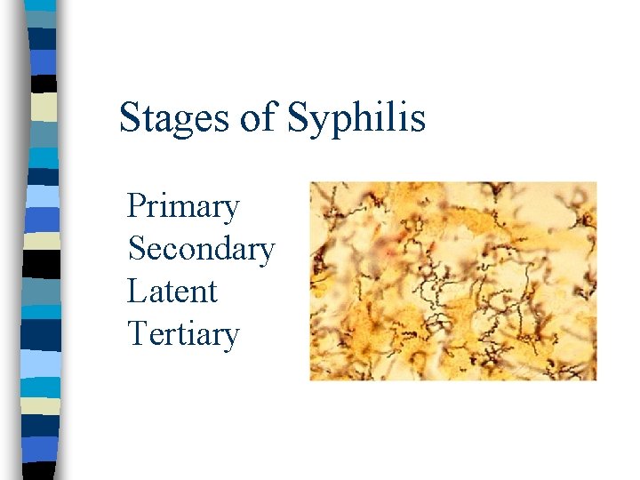 Stages of Syphilis Primary Secondary Latent Tertiary 