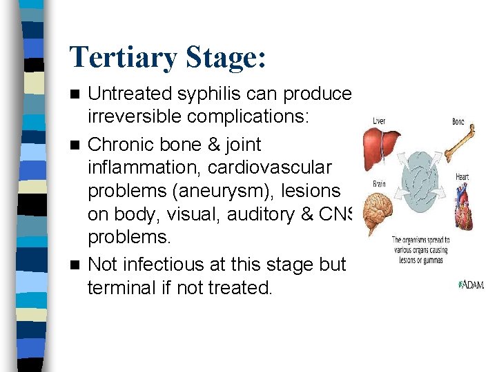 Tertiary Stage: Untreated syphilis can produce irreversible complications: n Chronic bone & joint inflammation,