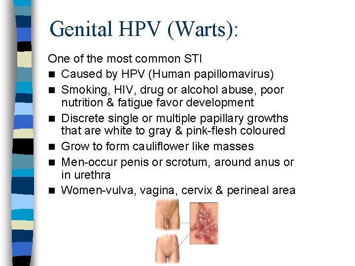 Genital HPV (Warts): One of the most common STI n Caused by HPV (Human