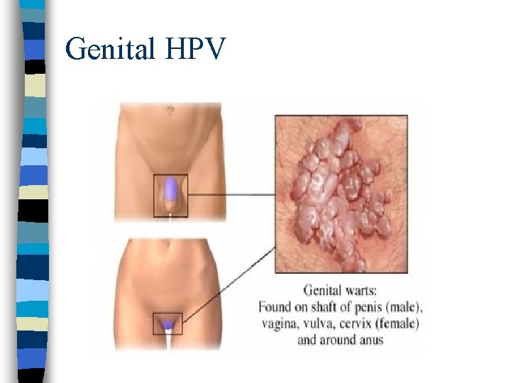 Genital HPV 