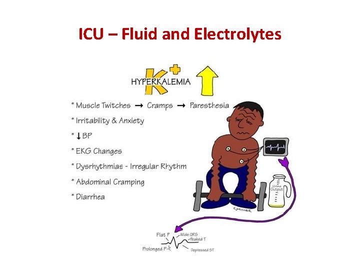 ICU – Fluid and Electrolytes 