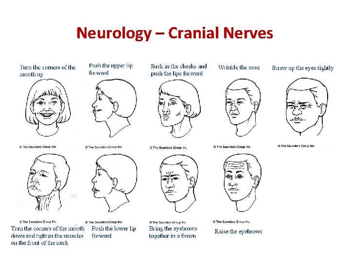 Neurology – Cranial Nerves 