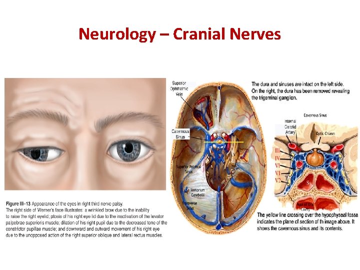 Neurology – Cranial Nerves 