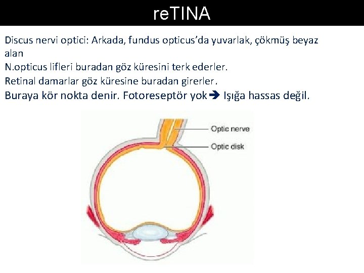 re. TINA Discus nervi optici: Arkada, fundus opticus’da yuvarlak, çökmüş beyaz alan N. opticus