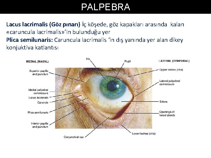 PALPEBRA Lacus lacrimalis (Göz pınarı) İç köşede, göz kapakları arasında kalan «caruncula lacrimalis» ’in PALPEBRA Lacus lacrimalis (Göz pınarı) İç köşede, göz kapakları arasında kalan «caruncula lacrimalis» ’in