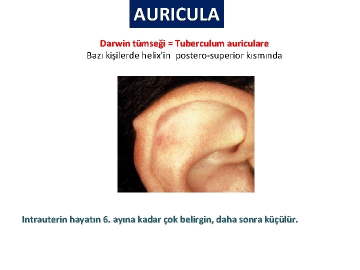 AURICULA Darwin tümseği = Tuberculum auriculare Bazı kişilerde helix’in postero-superior kısmında Intrauterin hayatın 6. AURICULA Darwin tümseği = Tuberculum auriculare Bazı kişilerde helix’in postero-superior kısmında Intrauterin hayatın 6.