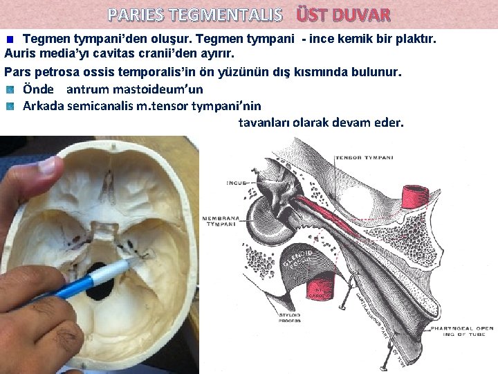 PARIES TEGMENTALIS ÜST DUVAR Tegmen tympani’den oluşur. Tegmen tympani - ince kemik bir plaktır. PARIES TEGMENTALIS ÜST DUVAR Tegmen tympani’den oluşur. Tegmen tympani - ince kemik bir plaktır.