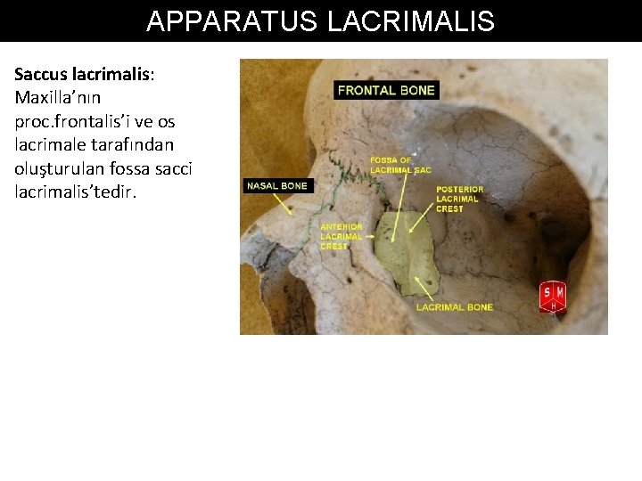 APPARATUS LACRIMALIS Saccus lacrimalis: Maxilla’nın proc. frontalis’i ve os lacrimale tarafından oluşturulan fossa sacci APPARATUS LACRIMALIS Saccus lacrimalis: Maxilla’nın proc. frontalis’i ve os lacrimale tarafından oluşturulan fossa sacci