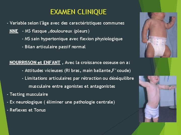 EXAMEN CLINIQUE - Variable selon l'âge avec des caractéristiques communes NNE - MS flasque