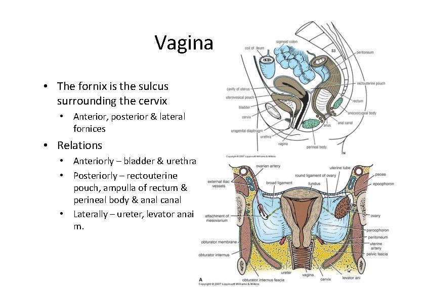 Vagina • The fornix is the sulcus surrounding the cervix • Anterior, posterior &