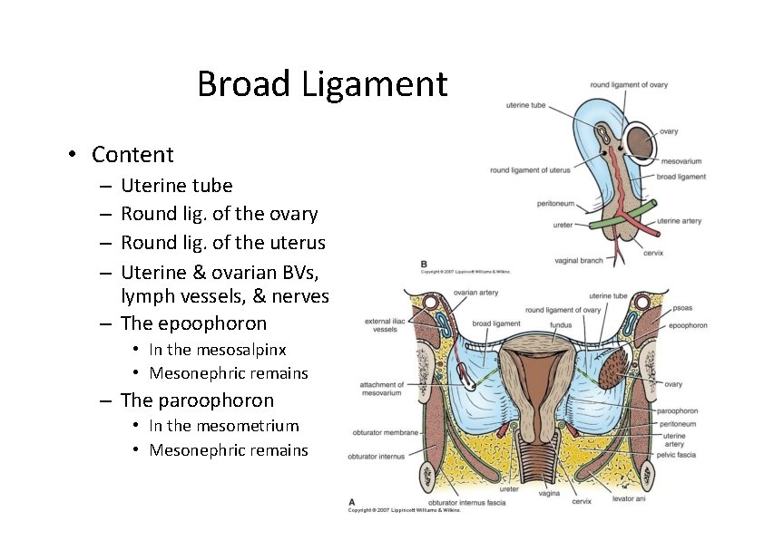 Broad Ligament • Content Uterine tube Round lig. of the ovary Round lig. of